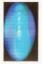 Aura after treatment